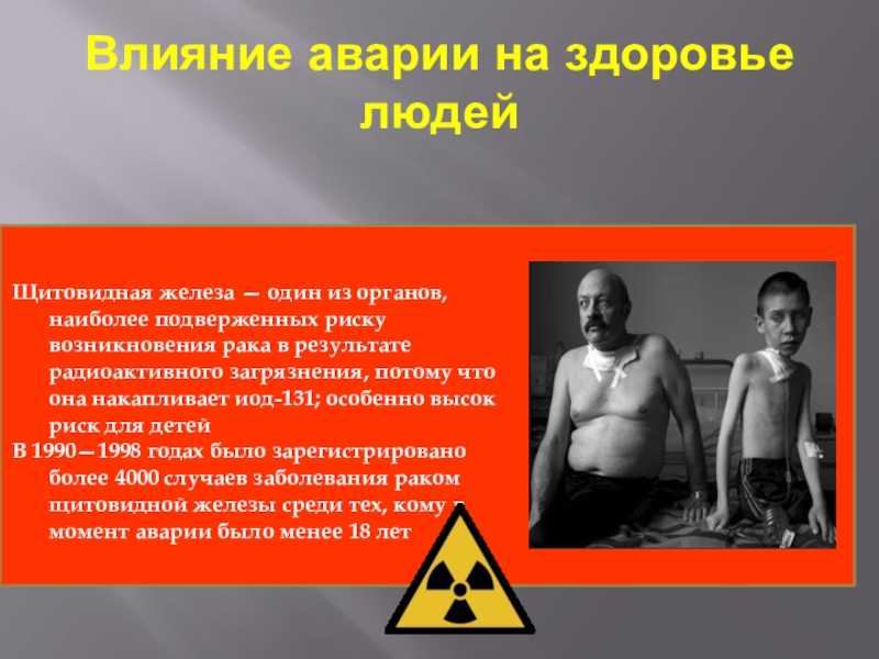 Люди заражение радиацией
